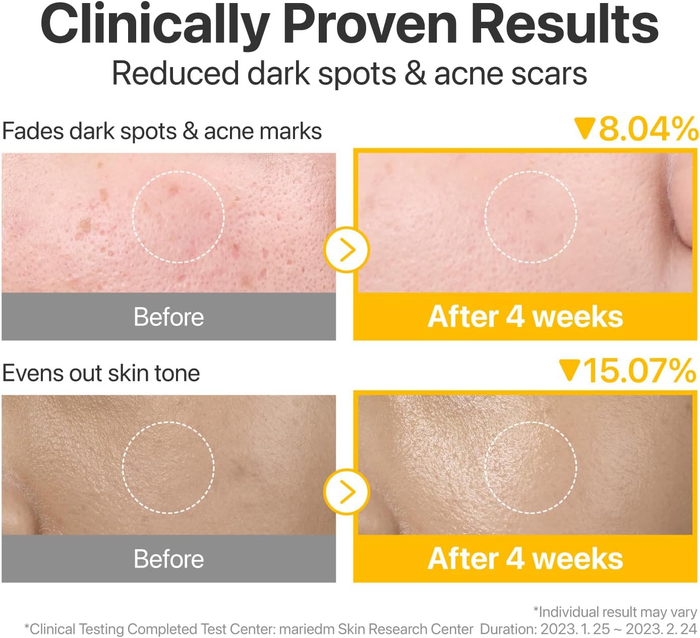 numbuzin No.5 Vitamin-Niacinamide Concentrated Toner Pads, 70 Pads