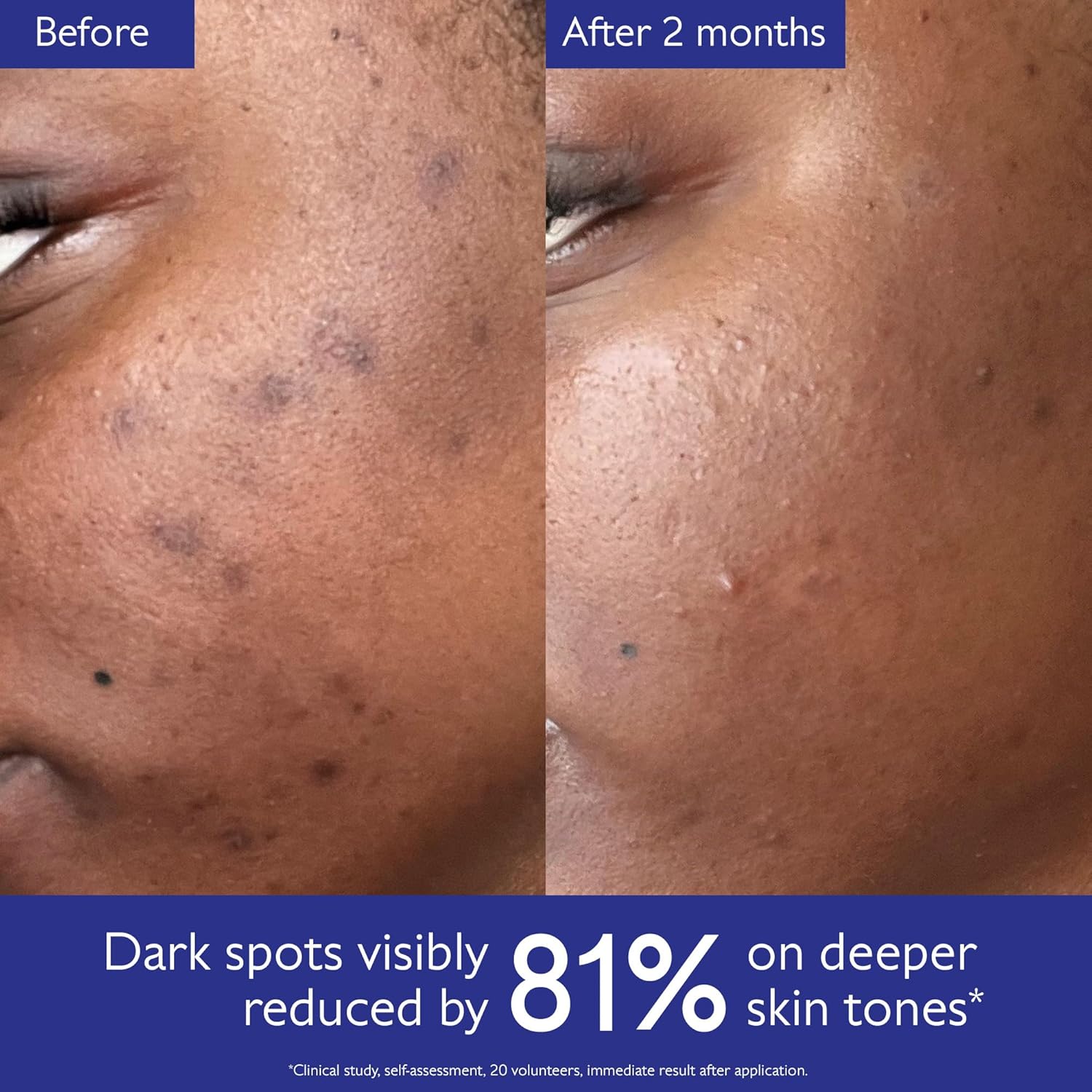 Caudalie Vinoperfect Brightening Dark Spot Serum Vitamin C - 30ml