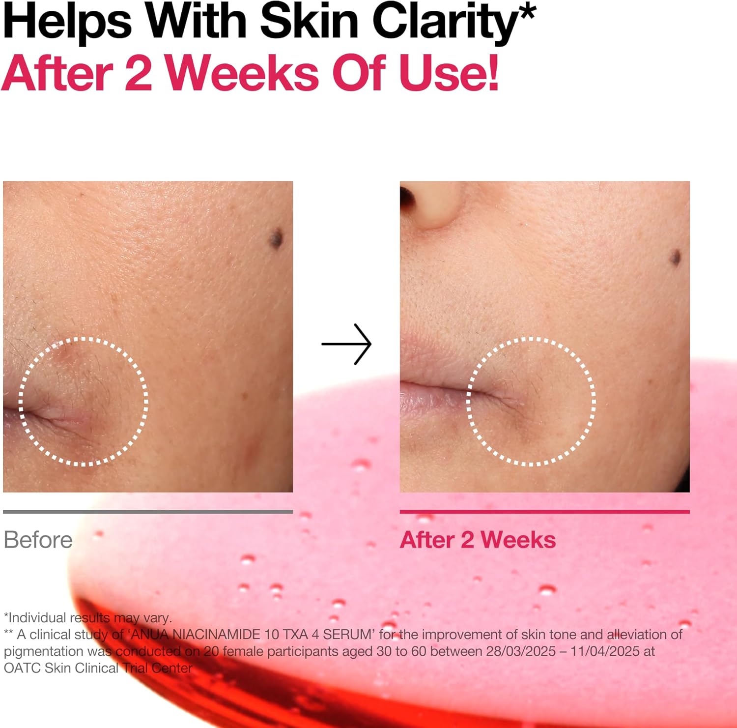 ANUA 10% Niacinamide + 4% TXA Serum - Dark Spot Treatment, 30 mL