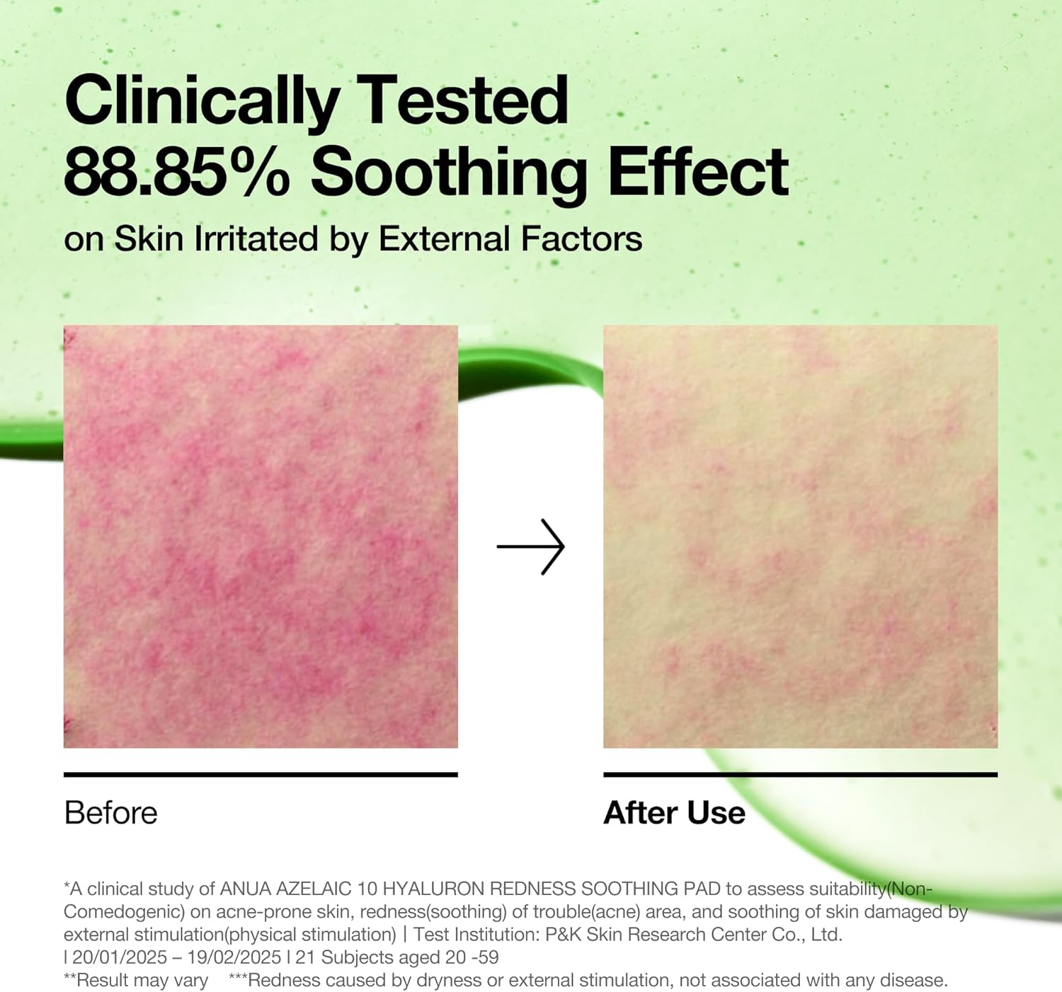 ANUA Azelaic 10 Hyaluron Redness Soothing Pads - Troubled & Spot Care, 90 Pads