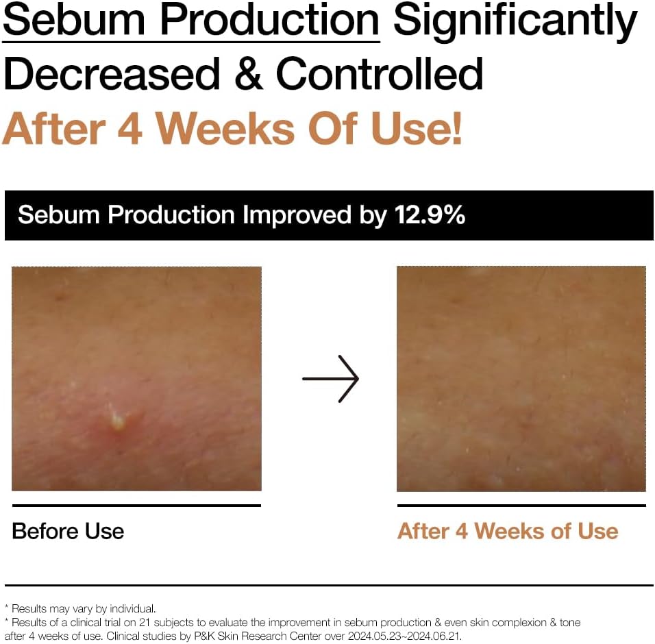 ANUA Rice 70 Glow Milky Toner - Brightening Essence Toner, 250 mL